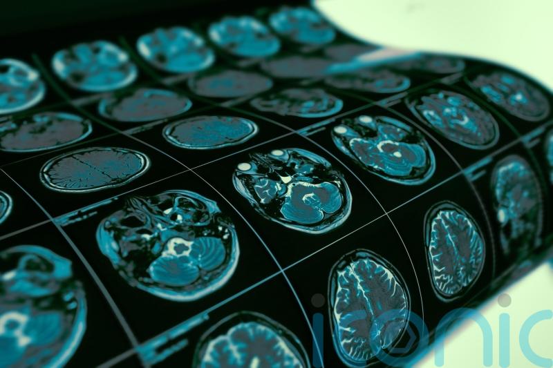 Top cancer charities to open brain tumour research centre in Scotland