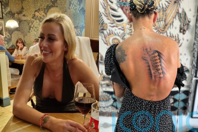 Fitness instructor with scoliosis raises £500 for tattoo of bolts in her collapsing spine to ‘stop the bullying’