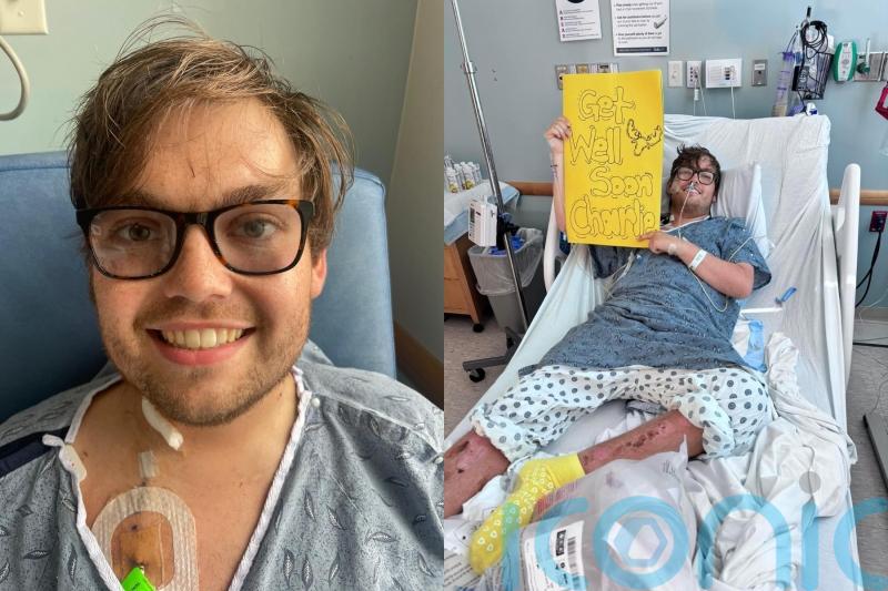 Student ‘died for 25 minutes’ during surgery in US after sunburn revealed pneumonia and undetected heart condition