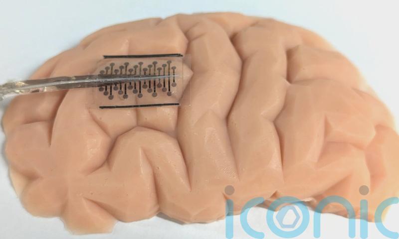 Folding implants that expand in the brain ‘could make epilepsy surgeries safer’