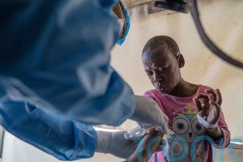 Democratic Republic of Congo reports more than 1,000 new mpox cases in a week