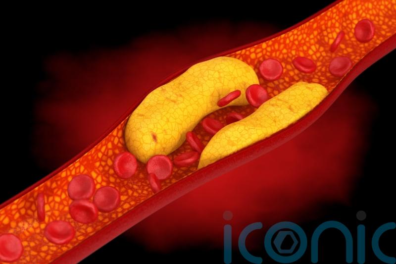 Consider lowering cholesterol ‘much earlier on in life’, researchers suggest