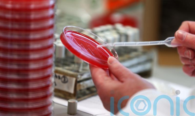 More than 39m could die from antibiotic-resistant infections by 2050 – study