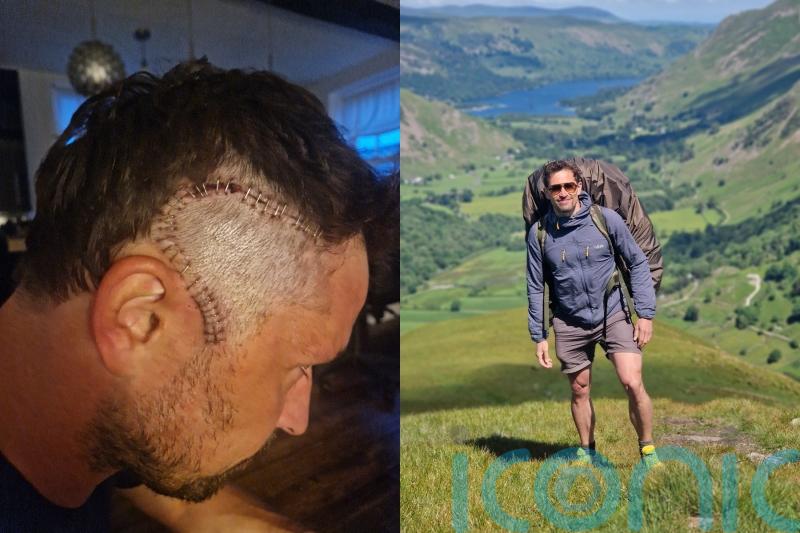 Former Royal Marine told headaches were because of dehydration given 18 months to live after brain cancer diagnosis