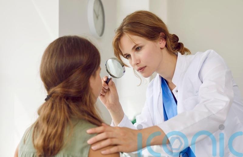 UK among countries with highest rates of acne for young people, study shows