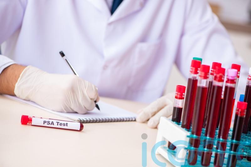 Charity calls for change to prostate cancer testing guidelines