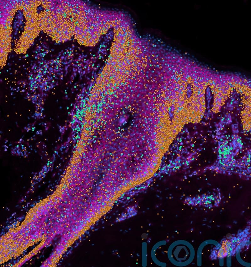 Human skin map gives ‘recipe’ to build skin and ‘could help prevent scarring’