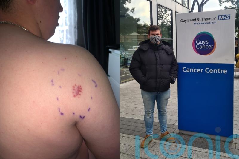 ‘Doctors thought itchy lump was ringworm or a tattoo allergy – it was cancer and I’ve paid £3k on travel for treatment’
