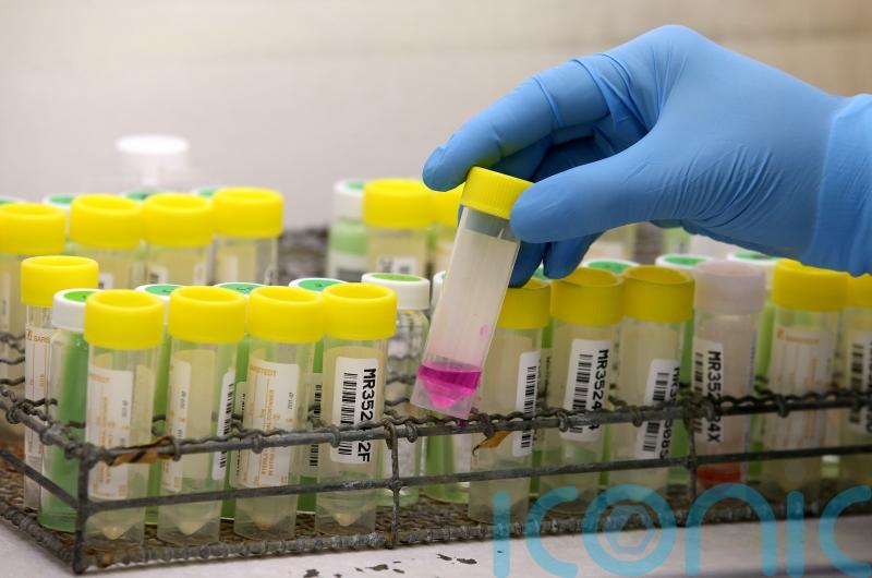 TB cases rose 40% in Scotland last year, figures show