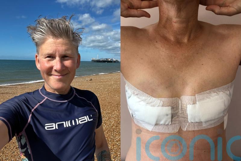 Non-binary parent finally ‘comfortable in their own skin’ after breast cancer prompts double mastectomy