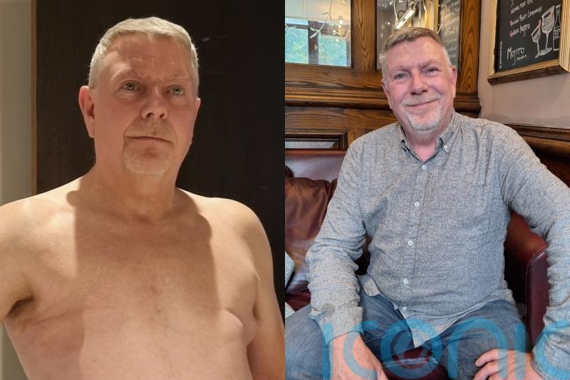 Don’t die of ignorance: Dad who initially ignored breast cancer says disease has returned in spine and is incurable