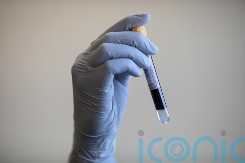 Blood test could ‘reliably rule out’ Alzheimer’s, trial finds