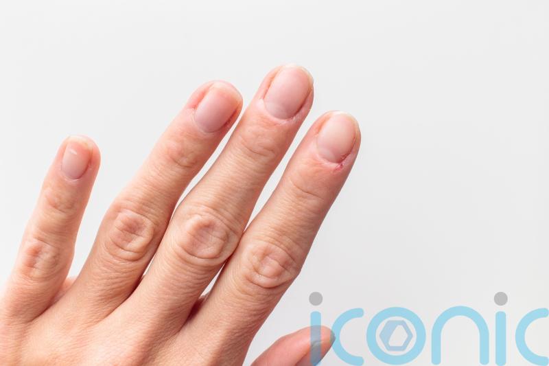 How to stop dry and cracked cuticles