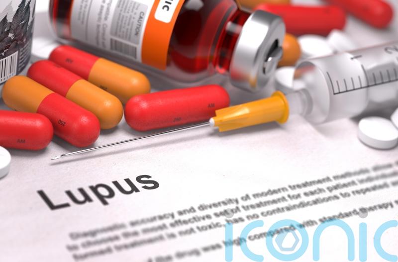 What is lupus and what are the symptoms?