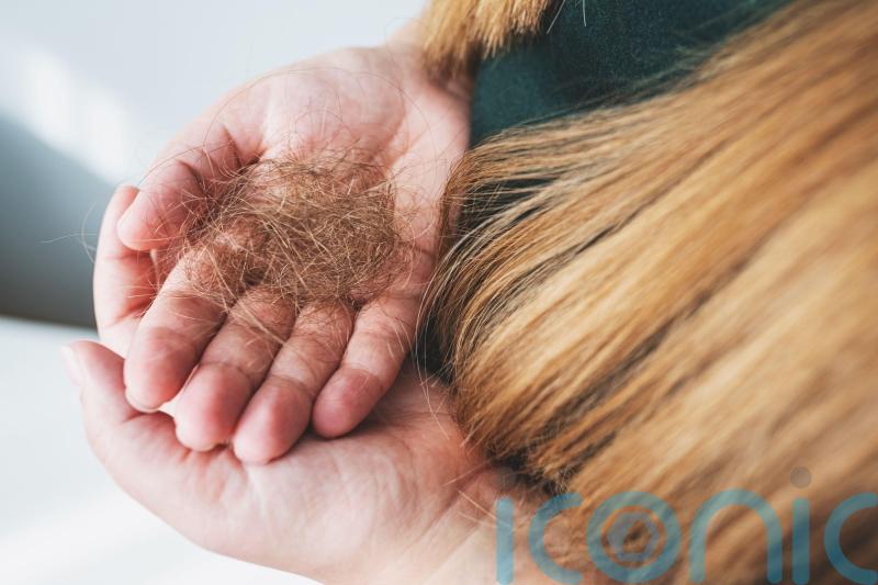 What is winter hair loss and how can you prevent it?