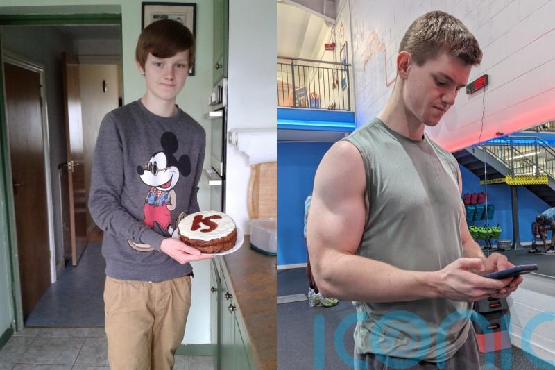 Musician diagnosed with anorexia as a teenager warns boys are at risk from exposure to fitness ‘propaganda’