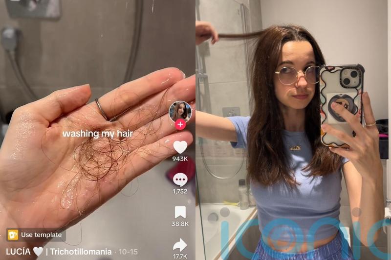 Trichotillomania sufferer shares methods to combat hair pulling disorder after millions watch her on TikTok