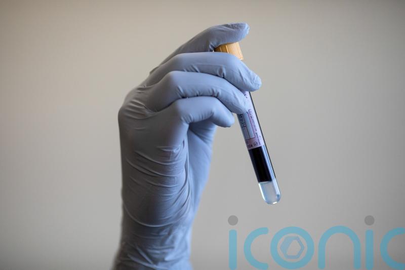 Blood tests could reduce lung cancer deaths, study finds