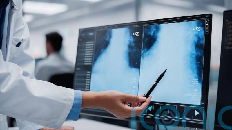 Robot-guided ‘smart biopsy’ technique tested on patients in UK first
