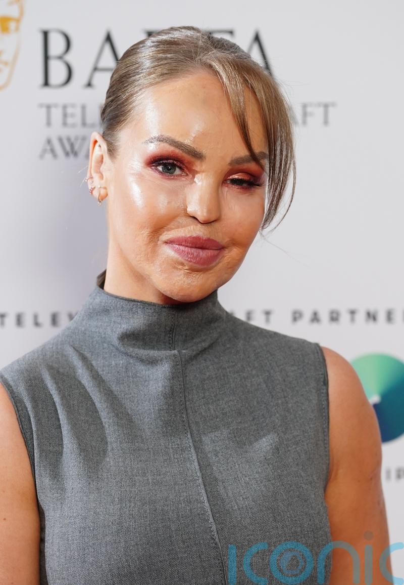 Katie Piper shares decision to get artificial eye 16 years after acid attack
