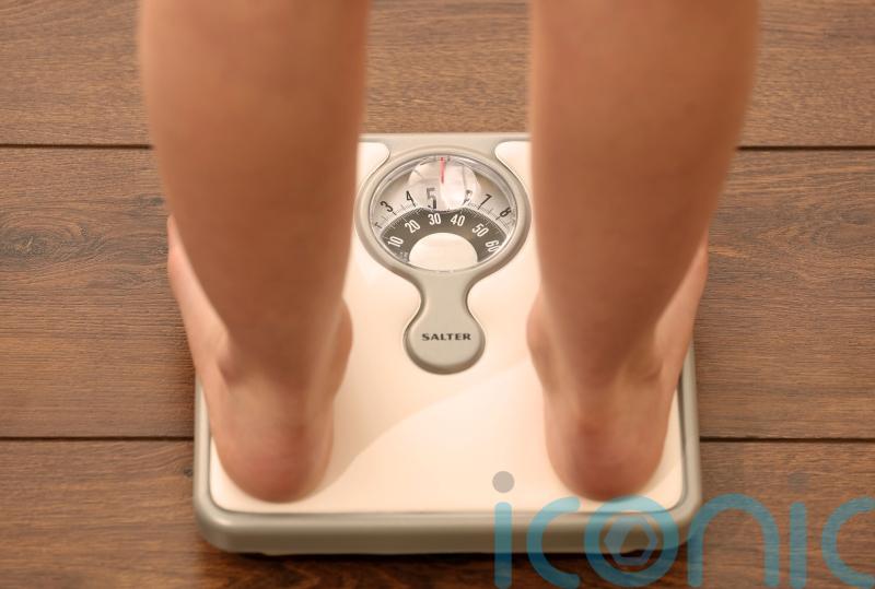 People ‘being misdiagnosed’ on obesity, say experts