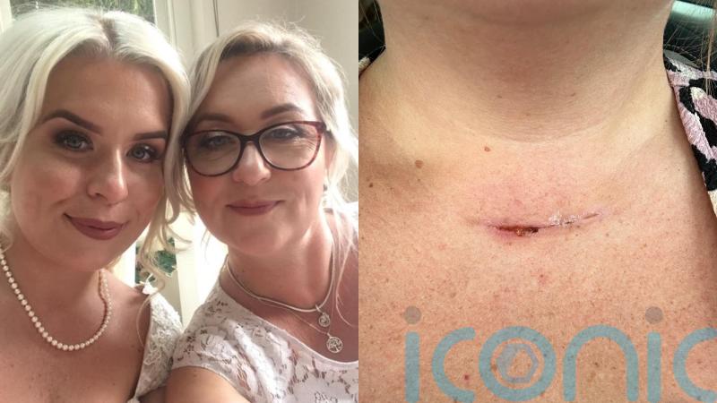 Mum and daughter hit by thyroid cancer diagnoses months apart after health workers thought they had menopause and asthma