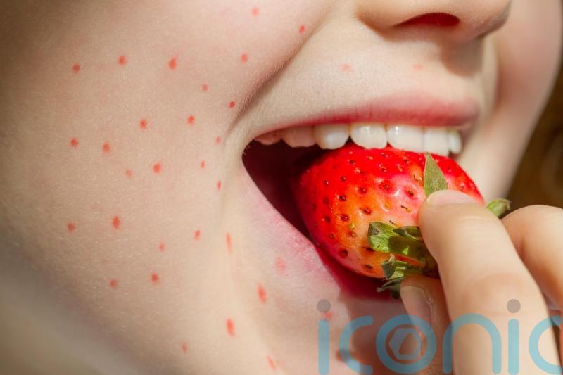 8 signs of food allergies in children you might not know