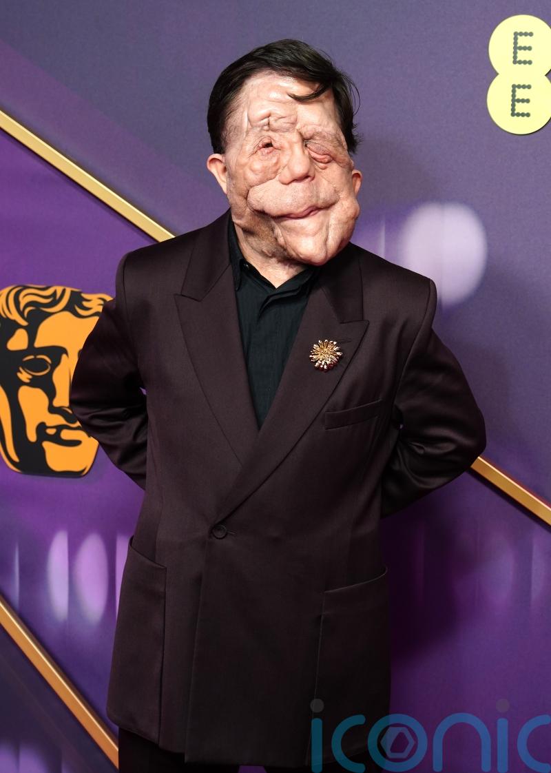 Film industry needs to stop seeing disability as a risk – A Different Man star