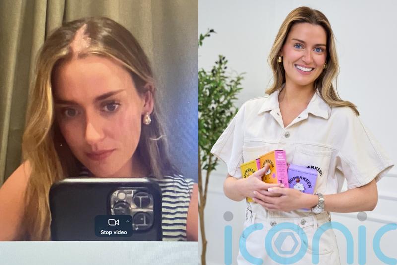 Roy Keane’s daughter shares lupus journey after dad’s humour and free-from superfoods helped her through ‘darkest times’