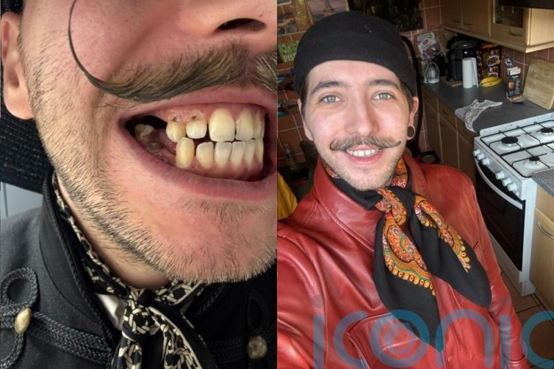 ‘NHS dentists don’t take my phobia seriously’ says man so fearful of a check up he has let his teeth ‘crumble away’