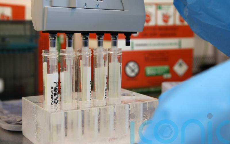 Staying prepared for future pandemics ‘absolutely vital’ – scientist