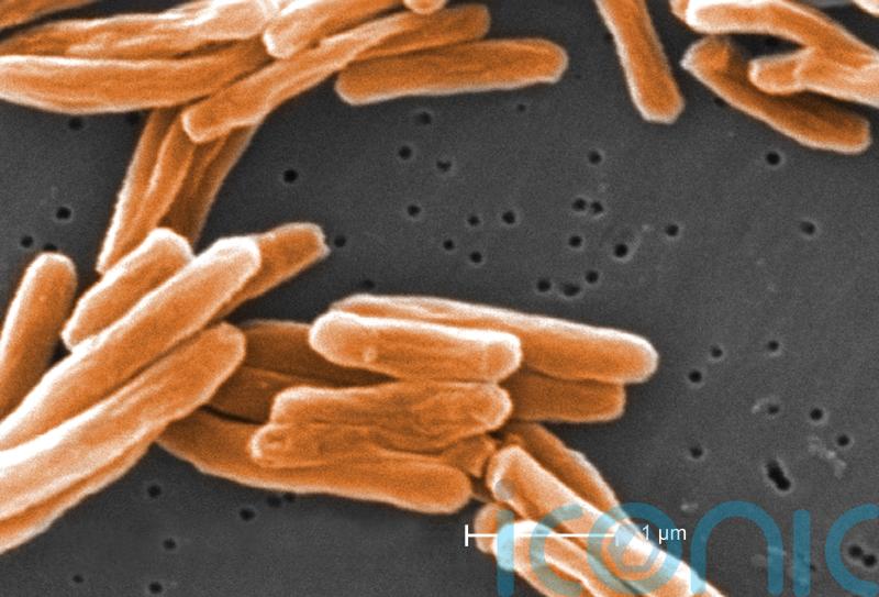 UK could lose low TB status amid rising cases, officials warn