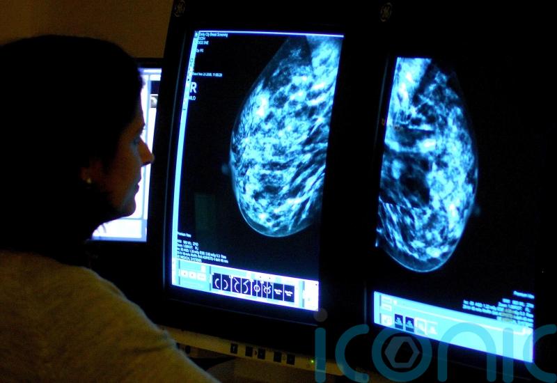 Breast cancer screenings uptake ‘shockingly low’, health minister tells MPs