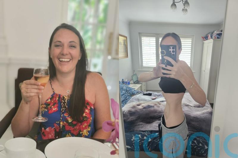 Woman who has not eaten normal meal for two years after Covid triggered condition had to pay for life-changing surgery