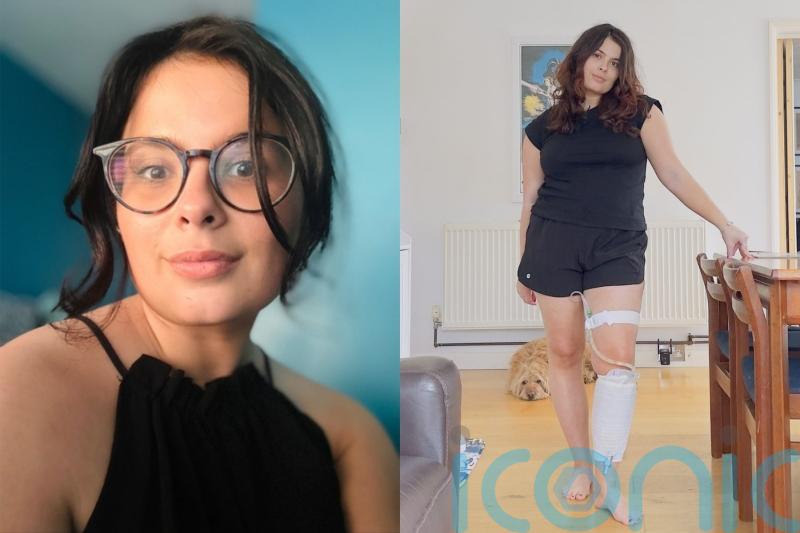 Woman, 29, who cannot urinate due to rare condition barred from Greggs disabled toilet &lsquo;until she showed catheter bag&rsquo;