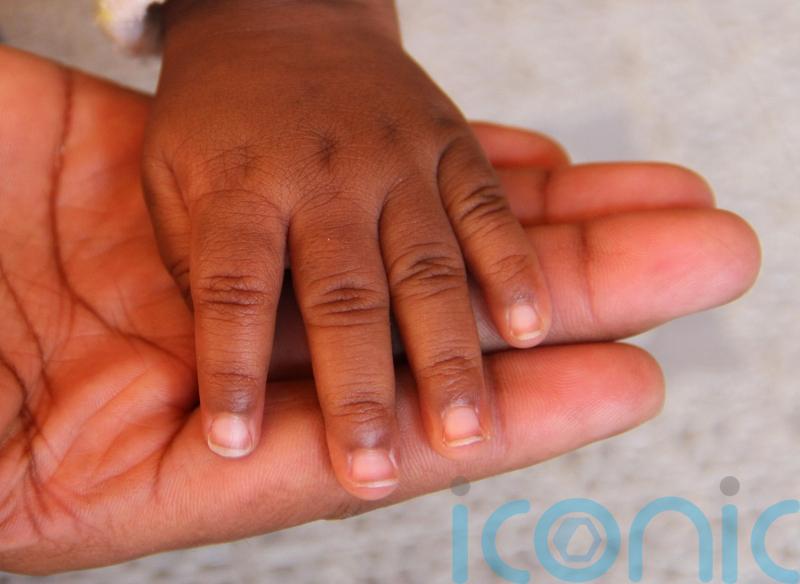 Fact check: Prematurity is the biggest global killer of children under five