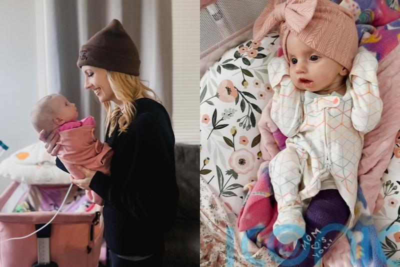 Mum of baby born with eyes wide open due to facial paralysis can sense daughter’s happiness even though she can’t smile
