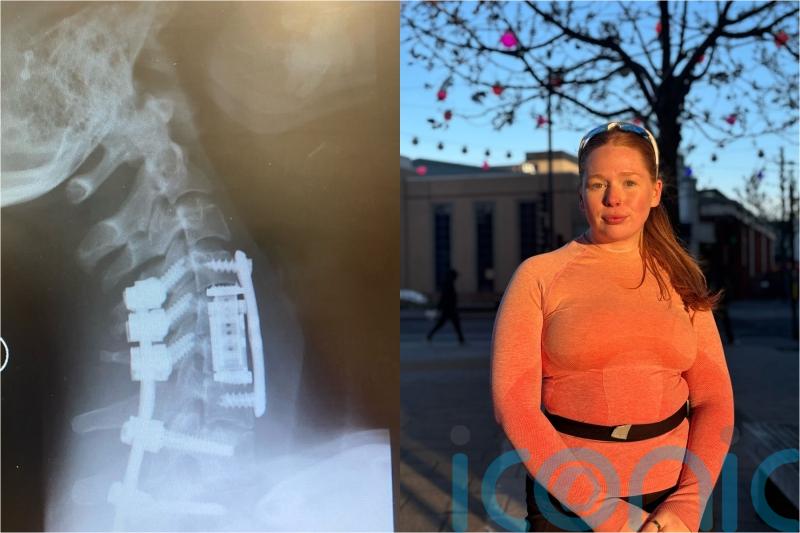 Woman who ‘partially decapitated’ herself after diving into pool and breaking neck on holiday ready for London Marathon