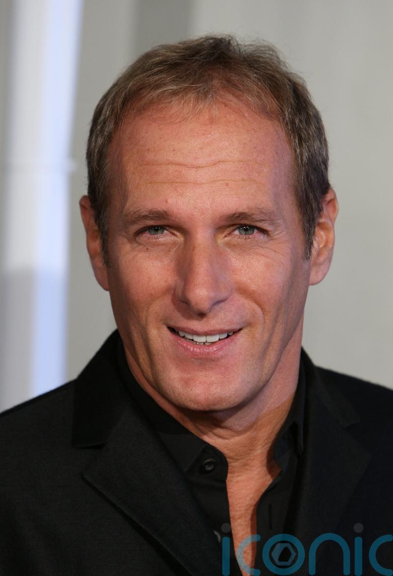 Michael Bolton’s daughter says he was ‘singing within minutes’ of brain surgery