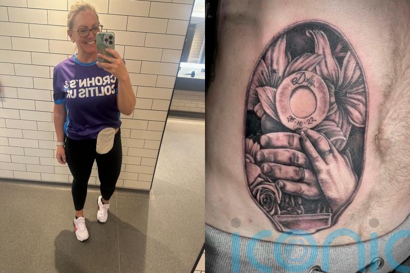 ‘Childhood bullies nearly killed me because of my colitis – now I push boundaries and my husband has a stoma bag tattoo’