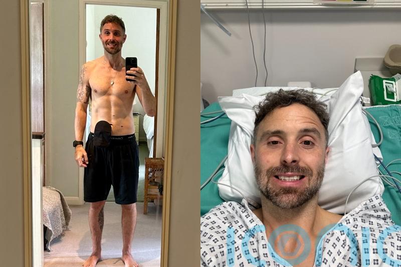 Runner whose bum pain led to buttock removal after shock cancer diagnosis &lsquo;hopes for Kim Kardashian-style replacement&rsquo;