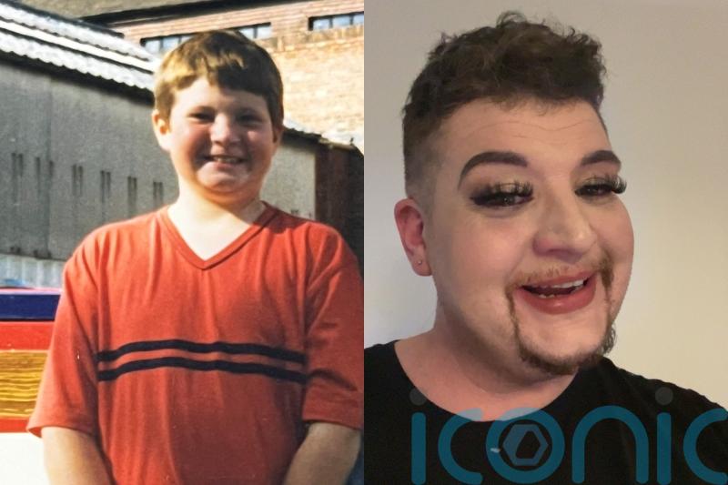 Intersex activist who felt like ‘alien’ for years campaigns for mandatory newborn screening to help end silent suffering