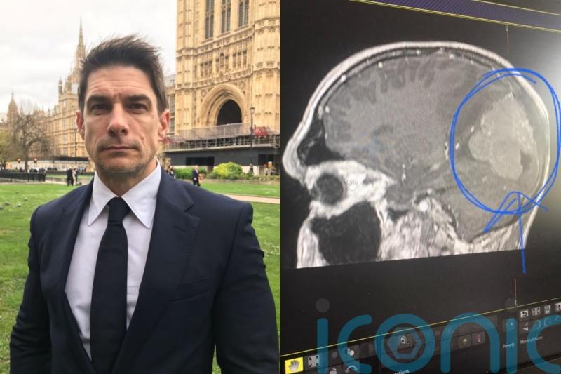 Actor who ‘nearly died’ after lime-sized tumour grew undetected and ‘deformed’ skull feels lucky to finish latest film