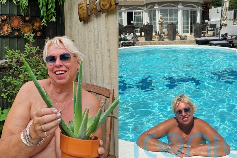 Nudist divorcee introduces live safety demonstrations for guests on how to ‘slather aloe vera on their bits’ for sunburn