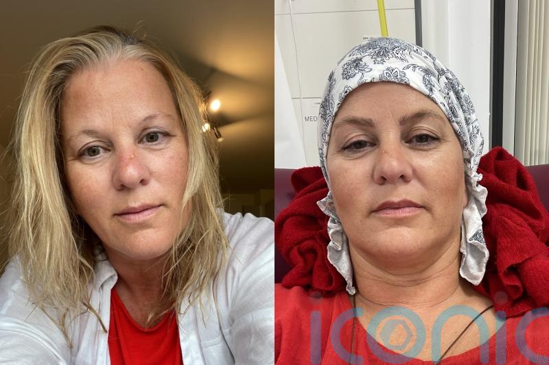 ‘This is my darkest day’: Two-time breast cancer survivor ‘completely let down’ by ‘botched’ NHS reconstruction surgery