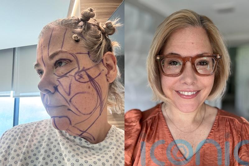 Mum, 52, whose face ‘looked sad all the time’ now told she looks ’20 years younger’ after rumoured Kris Jenner facelift