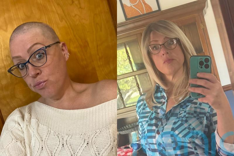 Widow who shaved her head after ‘manias’ caused her to spend hours pulling hairs from scalp says she ‘loves being bald’