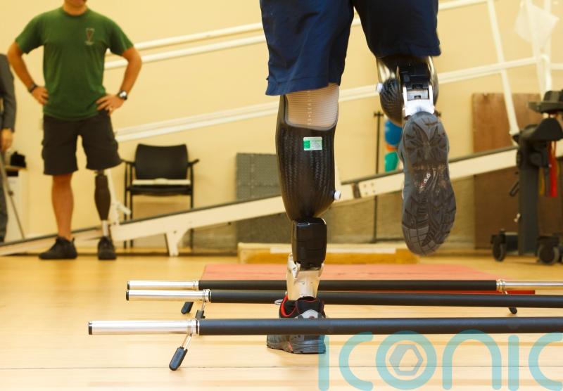 New software could reduce NHS waiting lists for prosthetic legs, study finds