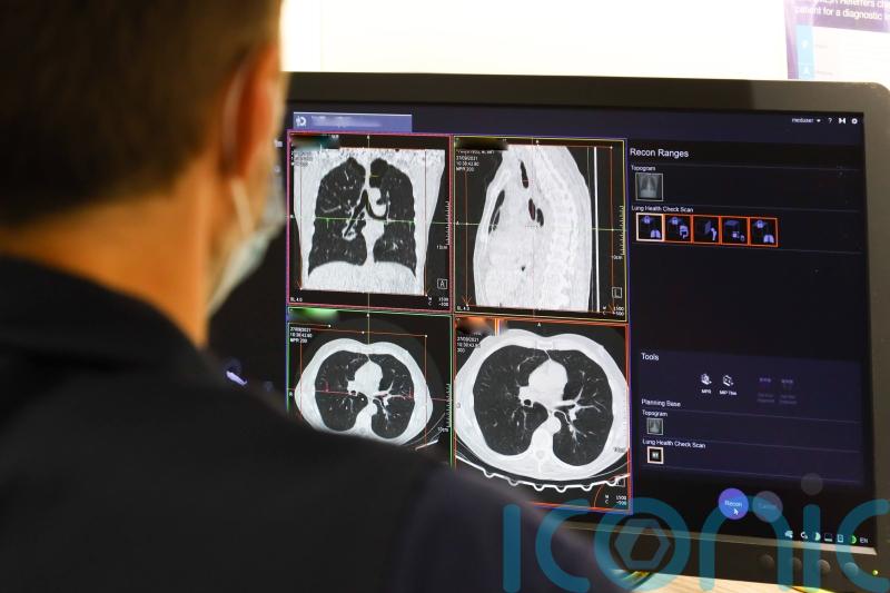 NHS trust warned of ‘neglect’ after failure to spot patient’s fatal lung cancer