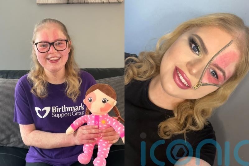 Woman ‘covered’ in marble-like birthmarks uses make up to challenge beauty stereotypes and celebrate visible differences